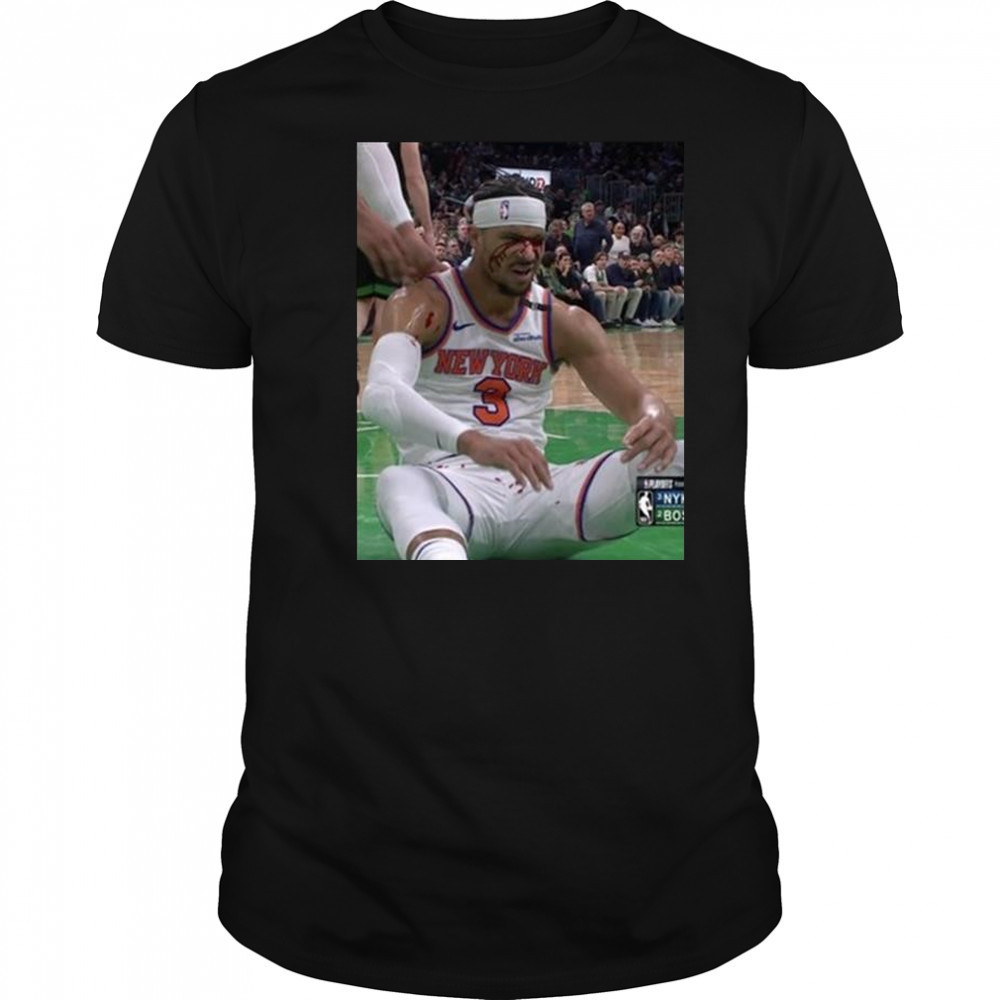 Photos Of Josh Hart After Getting Elbowed In The Face New York Knicks t-shirt