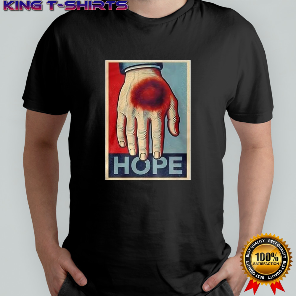 Donald Trump bruise hand Hope shirt