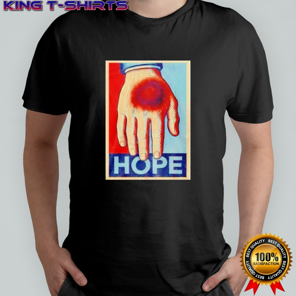 Donald Trump bruise hand hope shirt